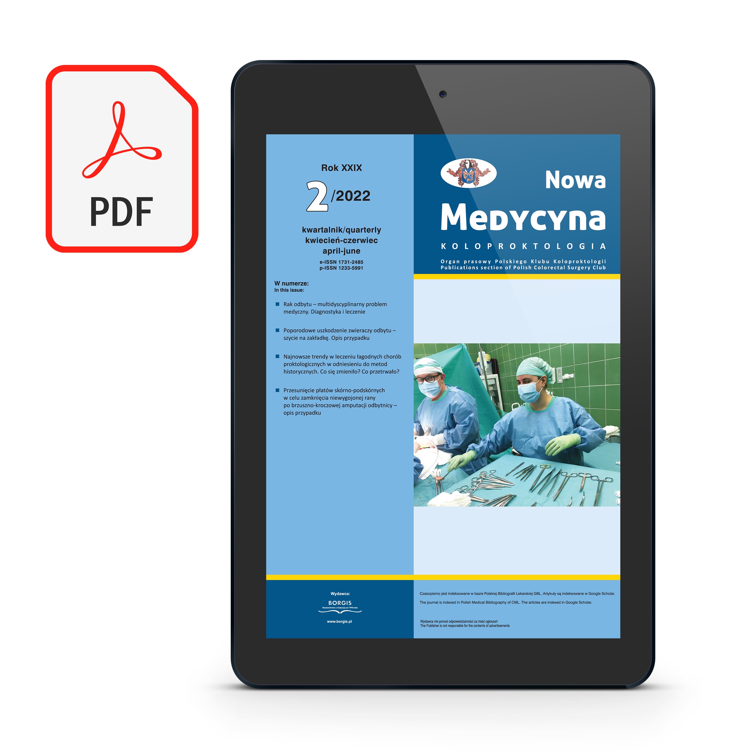 [PDF] Nowa Medycyna 2022/2 – Koloproktologia